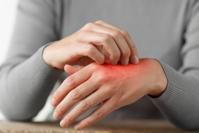 Dermatologue en ligne cas urgent, problème peau
