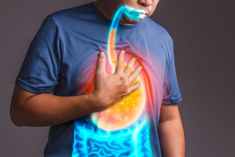 Remontées acides quels aliments à éviter symptôme reflus gastro-œsophagien (RGO)