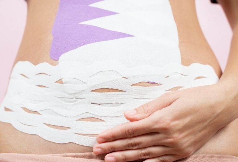 Diastasis abdominal quels impacts sur votre santé et comment le corriger