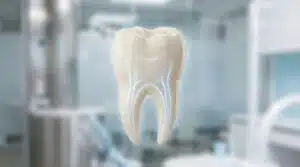 Dévitaliser une dent | guide pro, tarifs