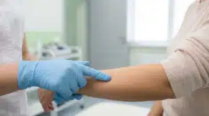 Professionnel de santé réalisant un examen cutané attentif pour identifier une excroissance de peau