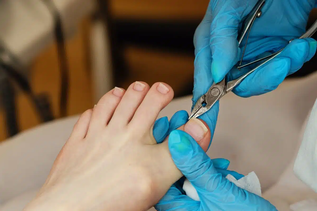 Pédicure médicale taillant l'ongle d'un orteil avec une pince professionnelle, mains gantées de bleu