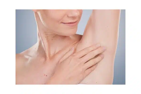 Facteurs favorisant la candidose cutanée Application d'une crème sur la peau pour prévenir une mycose des plis