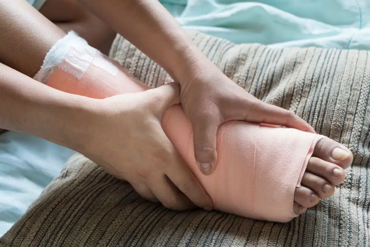 Tendinite du pied et du talon Pied bandé avec une bande de contention, prise en charge d’une tendinite du pied
